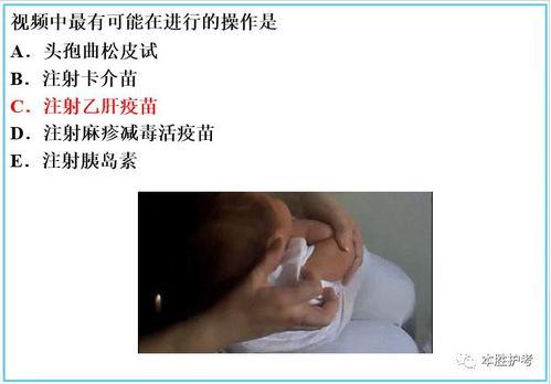 成人如何吸痧视频讲解图片,视频讲解图解全解析