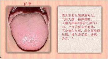 成人舌苔辨别图解视频,成人舌苔辨识技巧解析